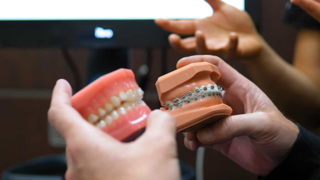 Close-up of orthodontic braces used to explain treatment options